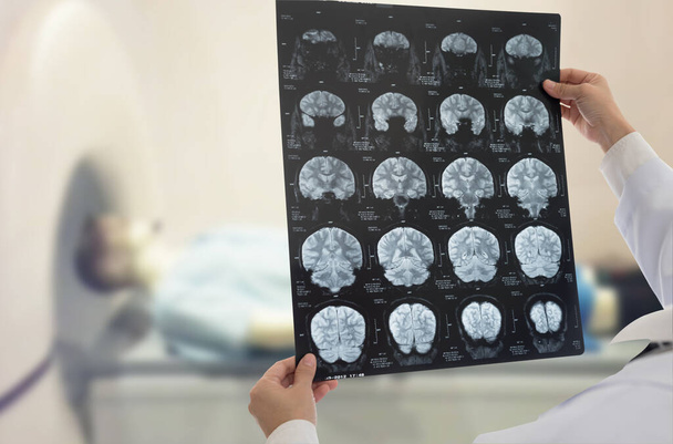 Ο γιατρός εξετάζει φιλμ ακτινογραφία του εγκεφάλου με μαγνητική τομογραφία του ασθενούς. - Φωτογραφία, εικόνα