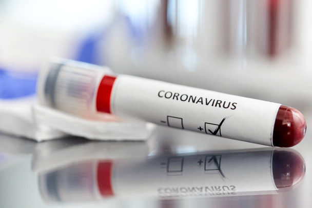 beaker with coronavirus blood test at laboratory - Fotografie, Obrázek
