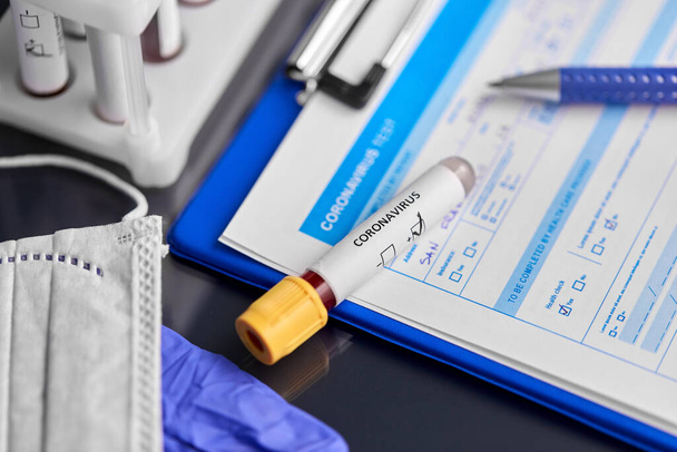 beaker with coronavirus blood test at hospital - Photo, image