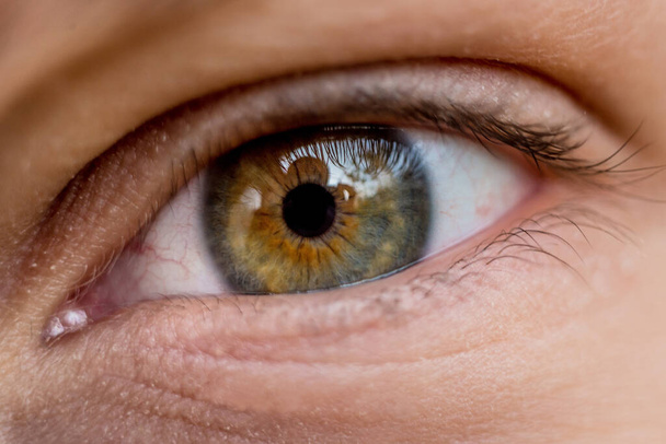 Eye close-up. Eye pupil.Konyuktevit. Eye diseases. Ophthalmology. Photo for ophthalmologists. Look straight. Eye hygiene  - Photo, Image