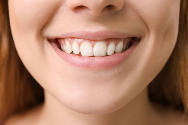 Mujer joven con dientes sanos, primer plano
 - Foto, imagen