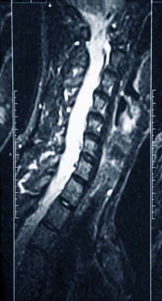 Raio-X do fragmento da coluna vertebral
 - Foto, Imagem