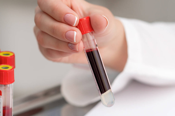 Il medico preleva il tubo del campione di sangue dal vassoio sul tavolo
. - Foto, immagini