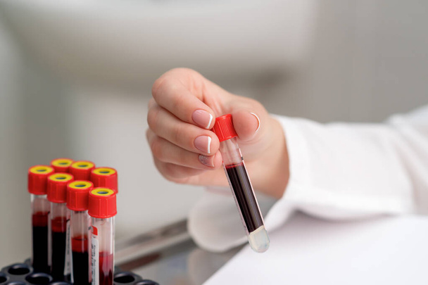 Médico mão segurando tubo de teste com amostra de sangue, de perto
. - Foto, Imagem