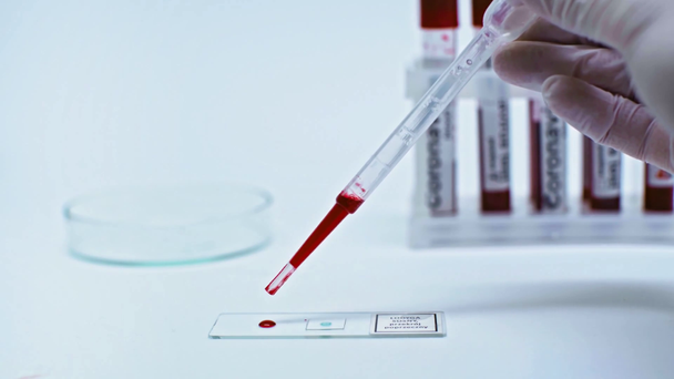 abgeschnittene Ansicht eines Wissenschaftlers, der Coronavirus-Blutprobe auf Laborglas legt - Filmmaterial, Video