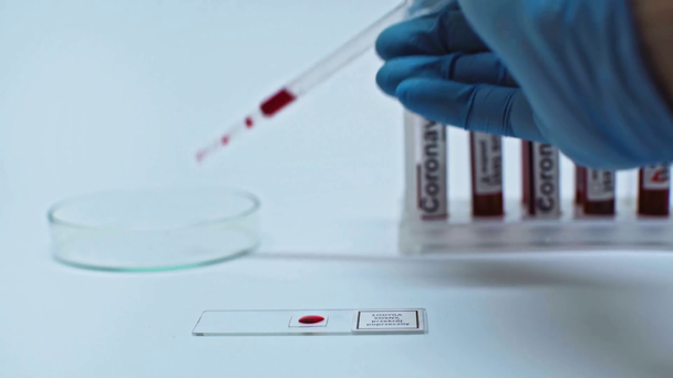 vue recadrée du scientifique ajoutant des gouttes de sang avec pipette sur verre de laboratoire
 - Séquence, vidéo