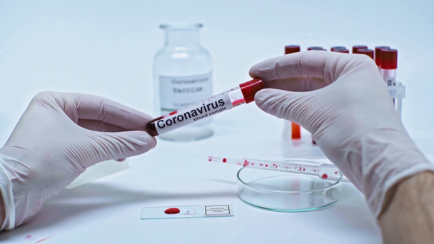 abgeschnittene Ansicht eines Wissenschaftlers mit Coronavirus-Blutprobe - Filmmaterial, Video