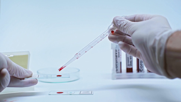 bijgesneden weergave van wetenschapper toevoegen van bloeddruppels met pipet in laboratoriumglas - Video