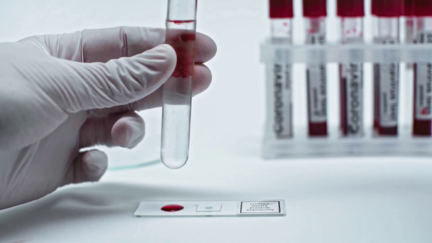 обрезанный взгляд ученого, добавляющего капли крови к коронавирусной вакцине
 - Кадры, видео