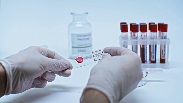 vista recortada del científico mostrando vidrio con gota de sangre y pulgar hacia arriba
 - Imágenes, Vídeo