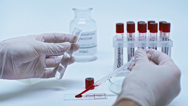 částečný pohled vědce přidávajícího kapky krve do koronavirové vakcíny - Záběry, video