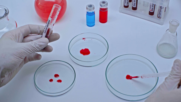 rajattu näkymä tiedemies lisäämällä koronaviruksen verinäyte petrimaljaan
 - Materiaali, video
