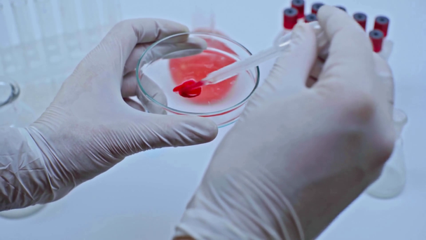Bilim adamının petri kabına kan damlaları ekleme görüntüsü - Video, Çekim
