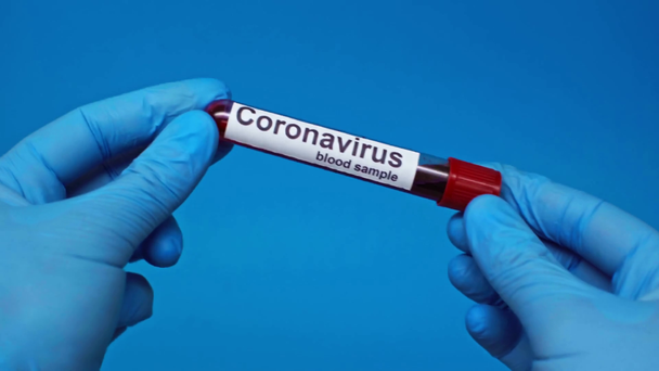 partial view of doctor showing coronavirus test tube isolated ob blue - Footage, Video
