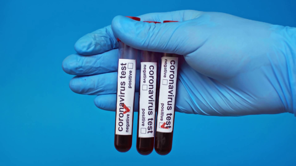 oříznutý pohled na lékaře ukazující koronavirové testy trubice izolované ob blue - Záběry, video