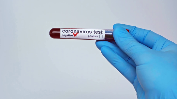 partial view of doctor holding negative coronavirus test isolated on grey - Footage, Video
