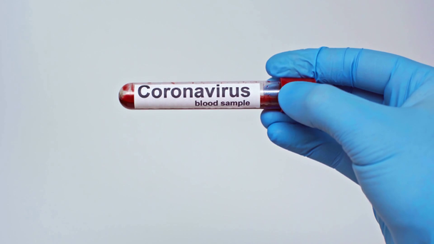 vista recortada del médico que sostiene el tubo de ensayo del coronavirus aislado en gris
 - Metraje, vídeo