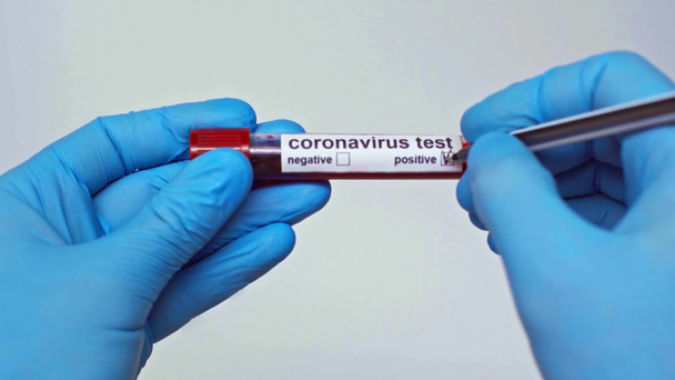 bijgesneden weergave van de positieve coronavirustest bij een arts die op grijs is geïsoleerd - Video