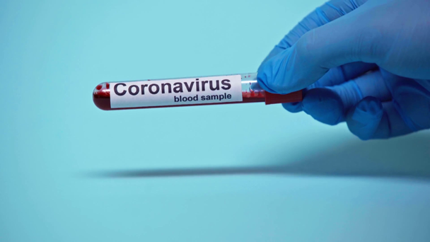 青い上にコロナウイルスのレタリングでチューブを取る医師のクロップドビュー  - 映像、動画
