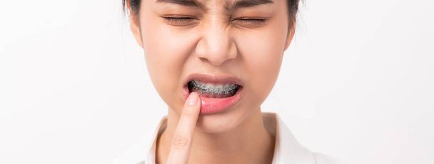Обличчя азіатської жінки пальцем торкається зубного болю, можливо через поганий догляд
. - Фото, зображення