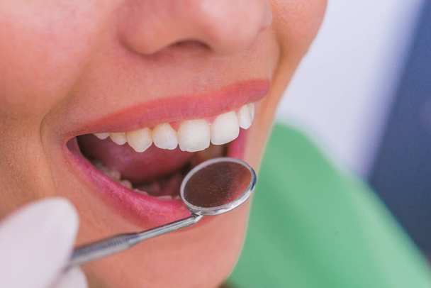 歯医者での口腔検査中に口を開いた女性患者の閉鎖. - 写真・画像