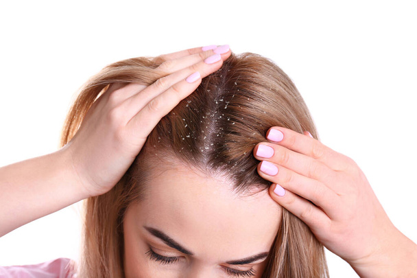 Woman with dandruff in her hair on white background, closeup - Foto, afbeelding
