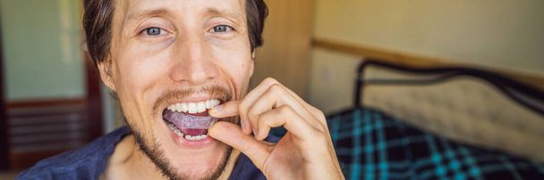Man placing a bite plate in his mouth to protect his teeth at night from grinding caused by bruxism, close up view of his hand and the appliance BANNER, LONG FORMAT - Foto, imagen