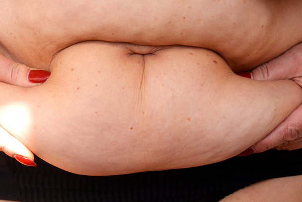 Nainen mittaa lihavaa vatsaa. Terveiden elämäntapojen käsite. Lihavuuden taustaa
 - Valokuva, kuva