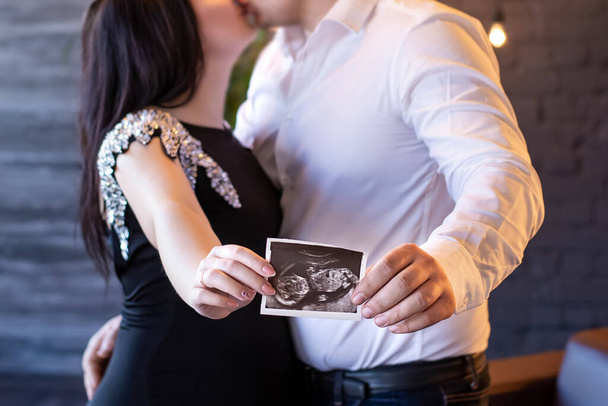 Stylish pregnant couple holding ultrasound scan of baby on baby bump and kissing. Young parents, happy mom and dad, holding in hands photo of their new child. Fertility and parenthood concept - Фото, изображение