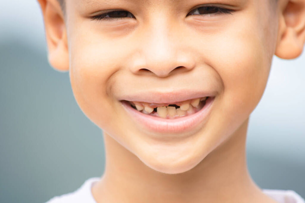 Dětské zuby jsou jen kapky v ústech. - Fotografie, Obrázek