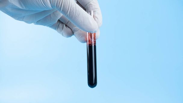 Doktorhände in Gummihandschuhen mit Blut im Reagenzglas COVID-19 auf blauem Hintergrund. Nahaufnahme mit Kopierraum - Foto, Bild