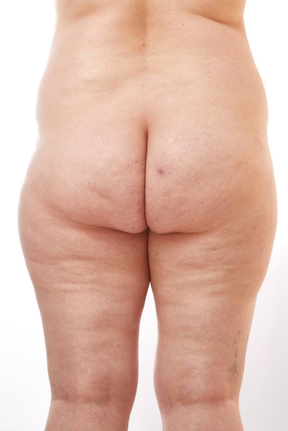 legs and buttocks of a 40-year-old woman with stretch marks, cellulite and varicose veins on a white isolated background - Foto, Imagem
