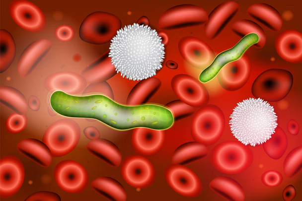 Sepsis (Blutinfektion). Äthologische Agenten der bakteriellen Sepsis. Sepsis ist eine entzündliche Immunreaktion, die durch eine Infektion ausgelöst wird. - Vektor, Bild
