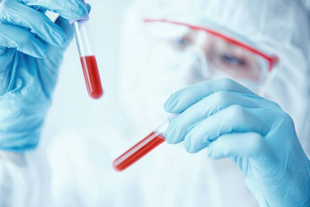 El médico del laboratorio de química analiza las pruebas para desarrollar vacunas contra el virus. Concepto humanidad y coronavirus - Foto, imagen