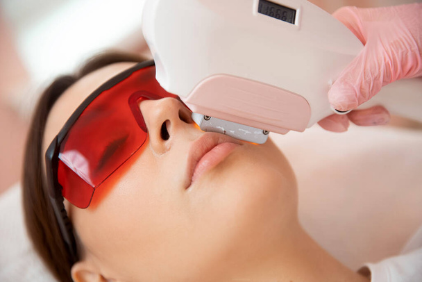 Usunięcie niechcianego lasera na wąsach młodej kobiety. Pojęcie piękna i zdrowia - Zdjęcie, obraz