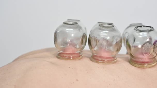 Traditional Chinese Medicine therapy. Cupping therapy, a treatment used for pain relief and other health benefits. - Footage, Video