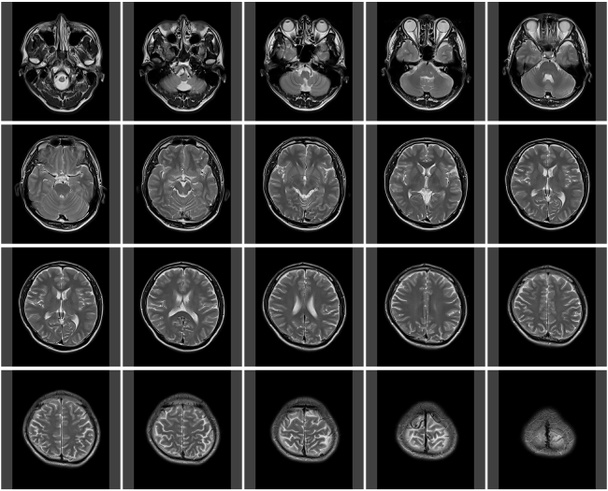 Маникюр показывает серию снимков головы с помощью МРТ
 - Фото, изображение