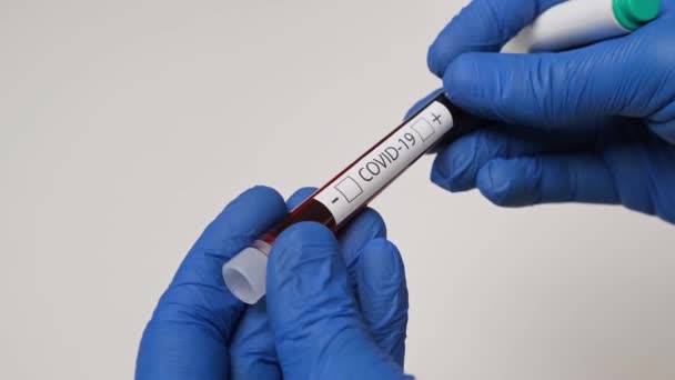 Negative result of COVID-19 test. Medical worker holding testing blood sample - Felvétel, videó