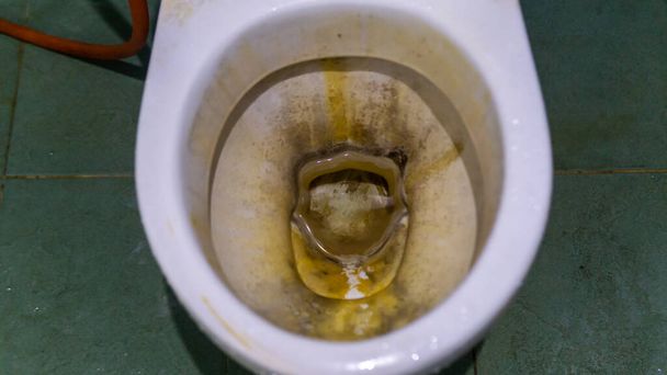 Schmutzige Toilettenschüssel mit gelbem Kalkfleck in einem Haus. Unhygienische, unsaubere und unangenehme Toilette. - Foto, Bild