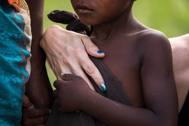 Szoros kép egy fehér nő kezét átöleli a szeretet és a védelem a fekete gyermekek. - Fotó, kép