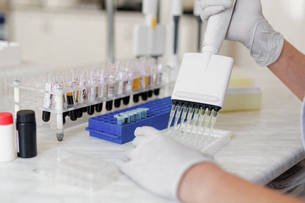 Orvosi felszerelések, vér- és genetikai minták elemzése a biotechnológiával rendelkező tudósok kezeinek laboratóriumában - Fotó, kép