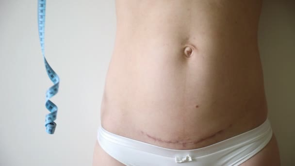 Γυναίκα με καισαρική τομή μετά τον τοκετό και μέτρο ταινία - Πλάνα, βίντεο