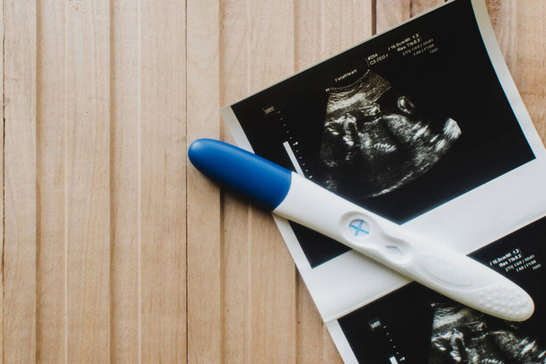 Tahta arka planda hamilelik testi olan bir ultrason. - Fotoğraf, Görsel
