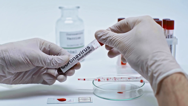 widok upraw naukowca pobierającego próbki krwi koronawirusa w pipecie - Materiał filmowy, wideo