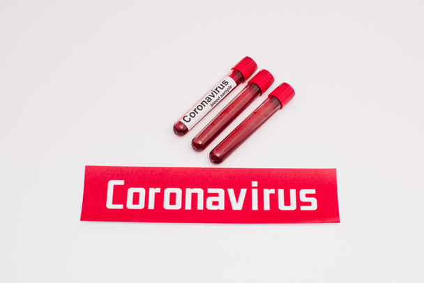 Magas szögű kilátás kártya koronavírus felirattal kísérőcsövek közelében vérmintákkal fehér  - Fotó, kép