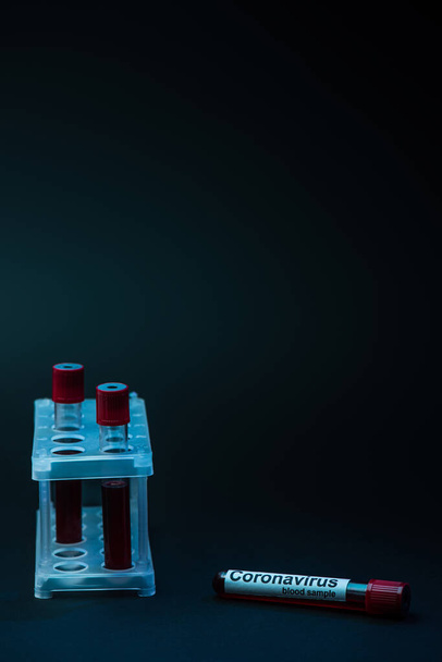 Образец коронавируса у стойки пробирки с трубками на тёмном фоне
 - Фото, изображение