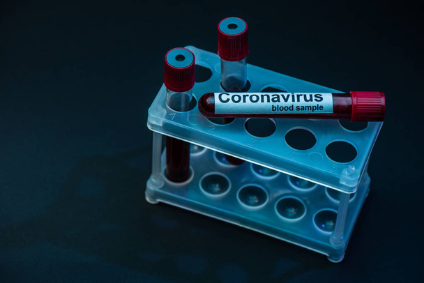 Visão de alto ângulo de tubos de amostra com amostras de sangue de coronavírus em rack de tubo de teste no escuro
 - Foto, Imagem