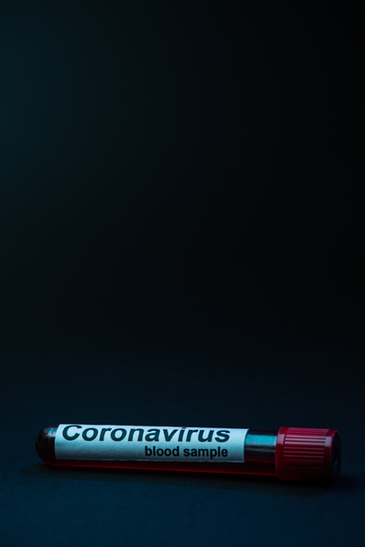 Tube à essai avec échantillon de sang de coronavirus sur fond sombre
 - Photo, image