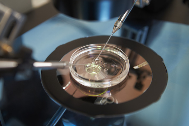 Laboratory Fertilization Of Eggs In IVF Treatment - Фото, изображение