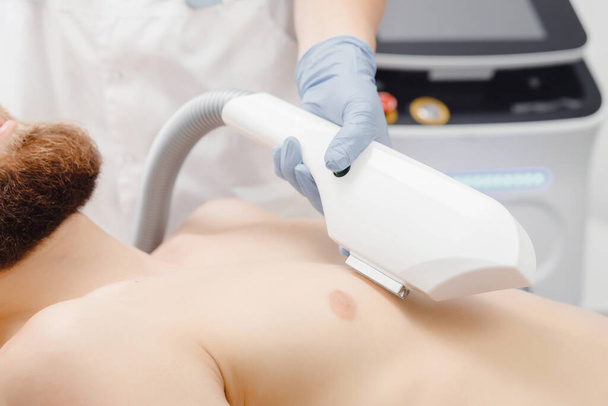Male depilation laser hair removal chest procedure treatment - Foto, afbeelding